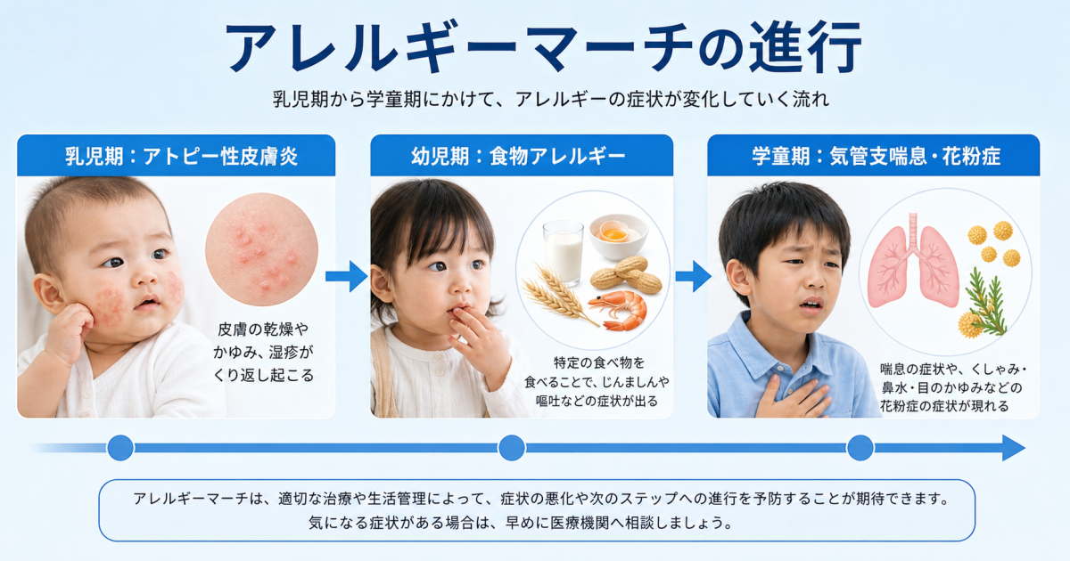 アレルギーマーチの仕組みと進行のサイン